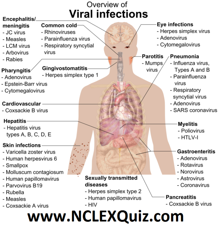 Overview of the Viral Infections Chart NCLEX Quiz