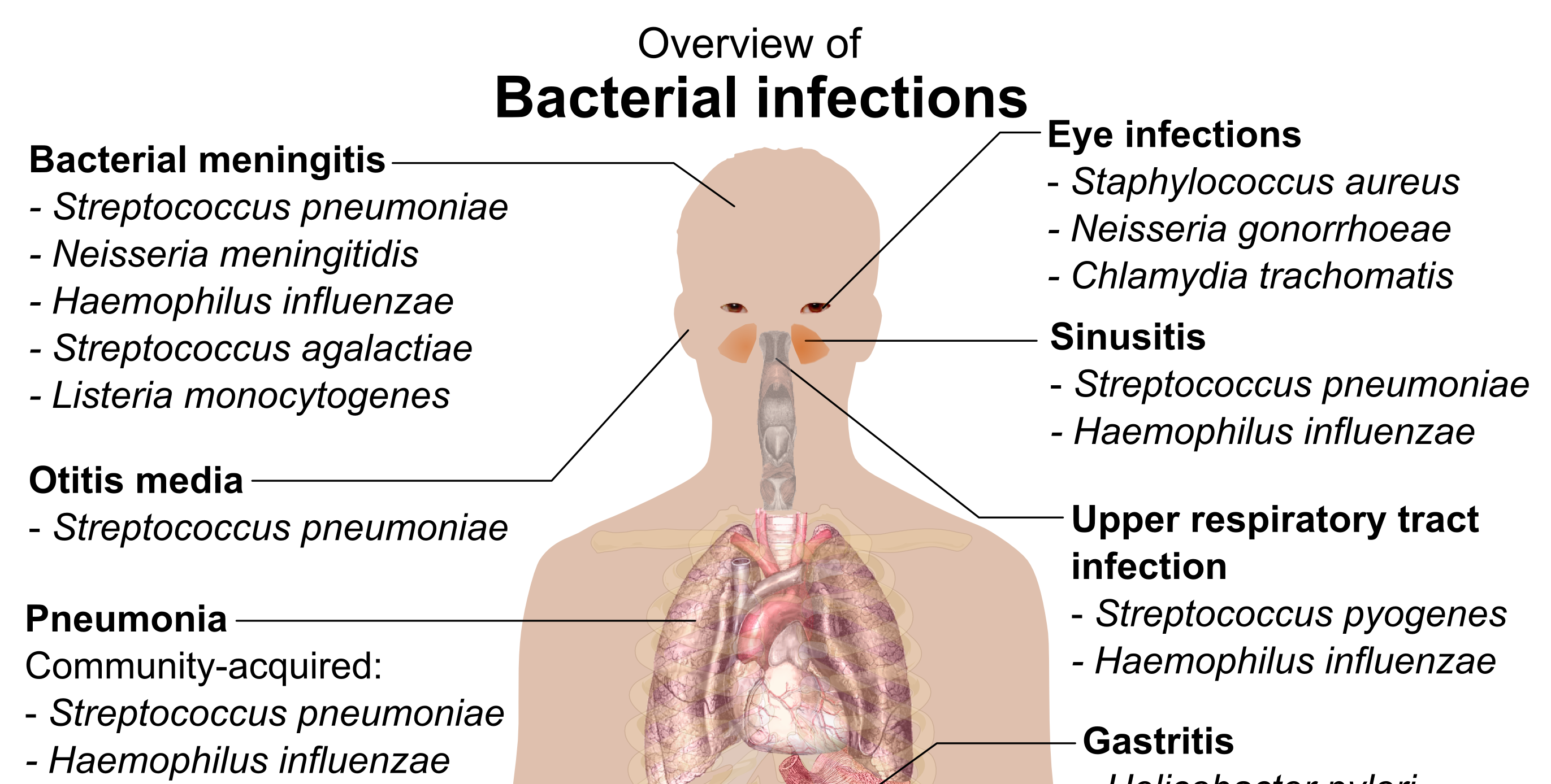 Bacterial Infections Pictures