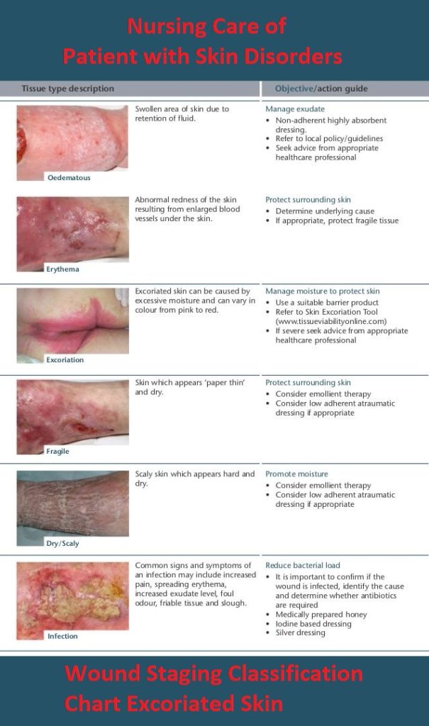Nursing Care Of Patient With Skin Disorders Wound Staging Classification Chart Excoriated Skin 605x1024 