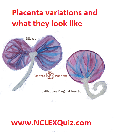 battledore placenta