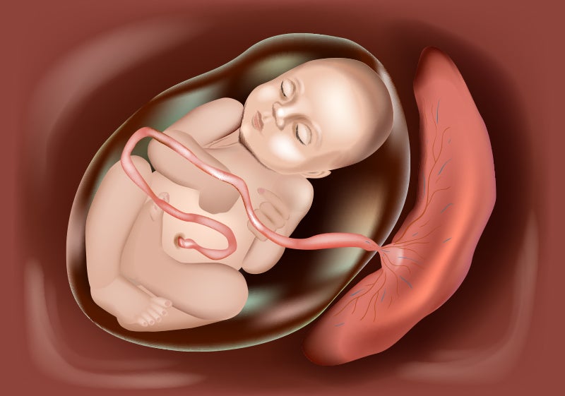 Difference between the Placenta and Umbilical Cord